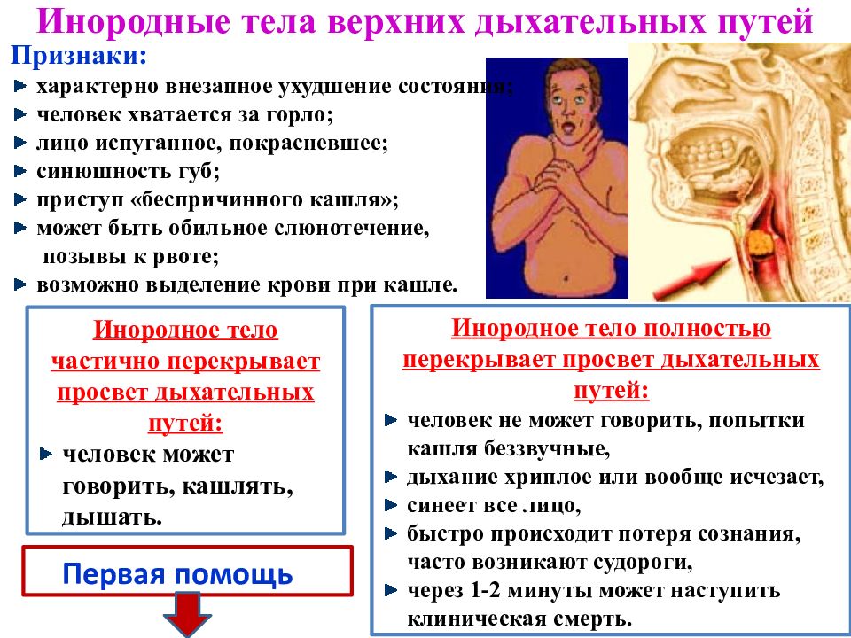 Первая помощь при отсутствии кровообращения презентация