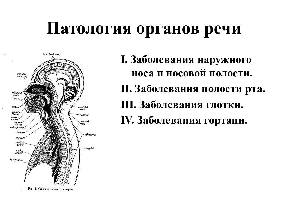 Патологии органов речи схема