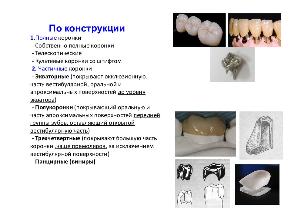 Штампованные коронки презентация