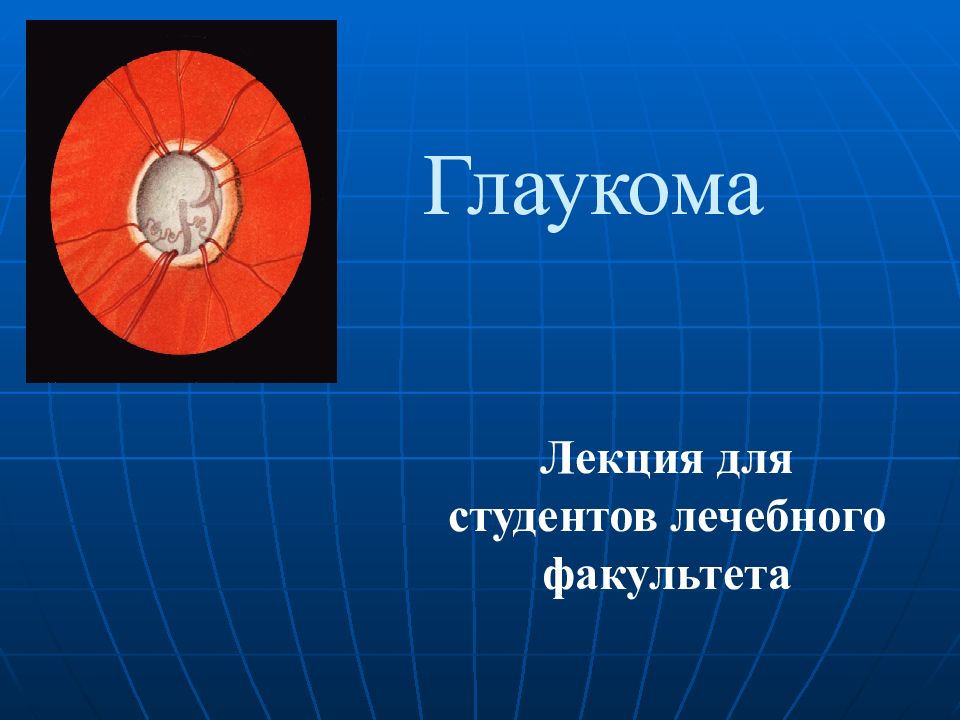 Глаукома