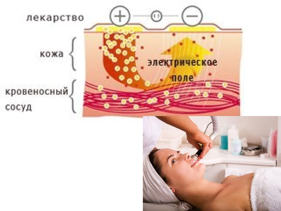 Лекарственный электрофорез. Лечебные эффекты лекарственного электрофореза. Лекарственный электрофорез механизм действия. Лекарственный электрофорез презентация.