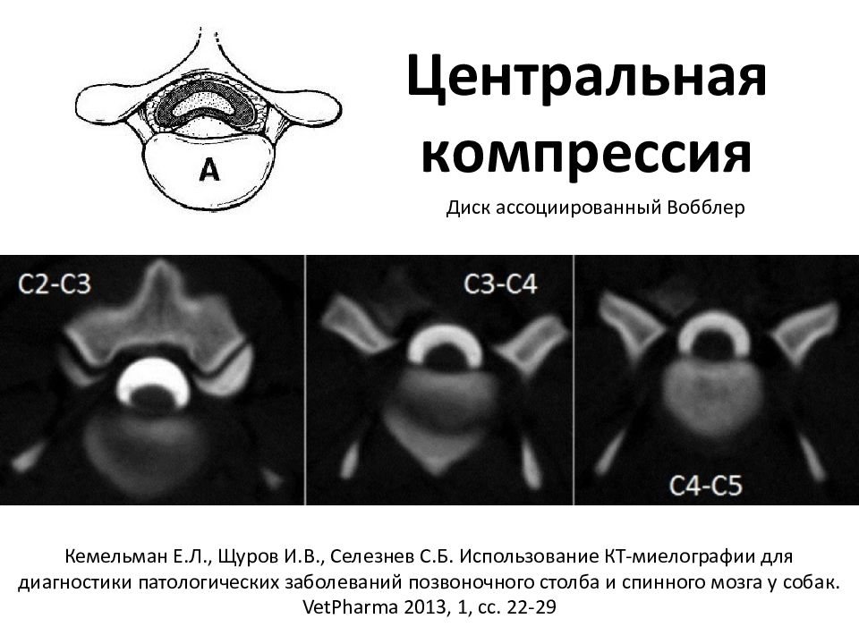 Компьютерная томография в неврологии презентация