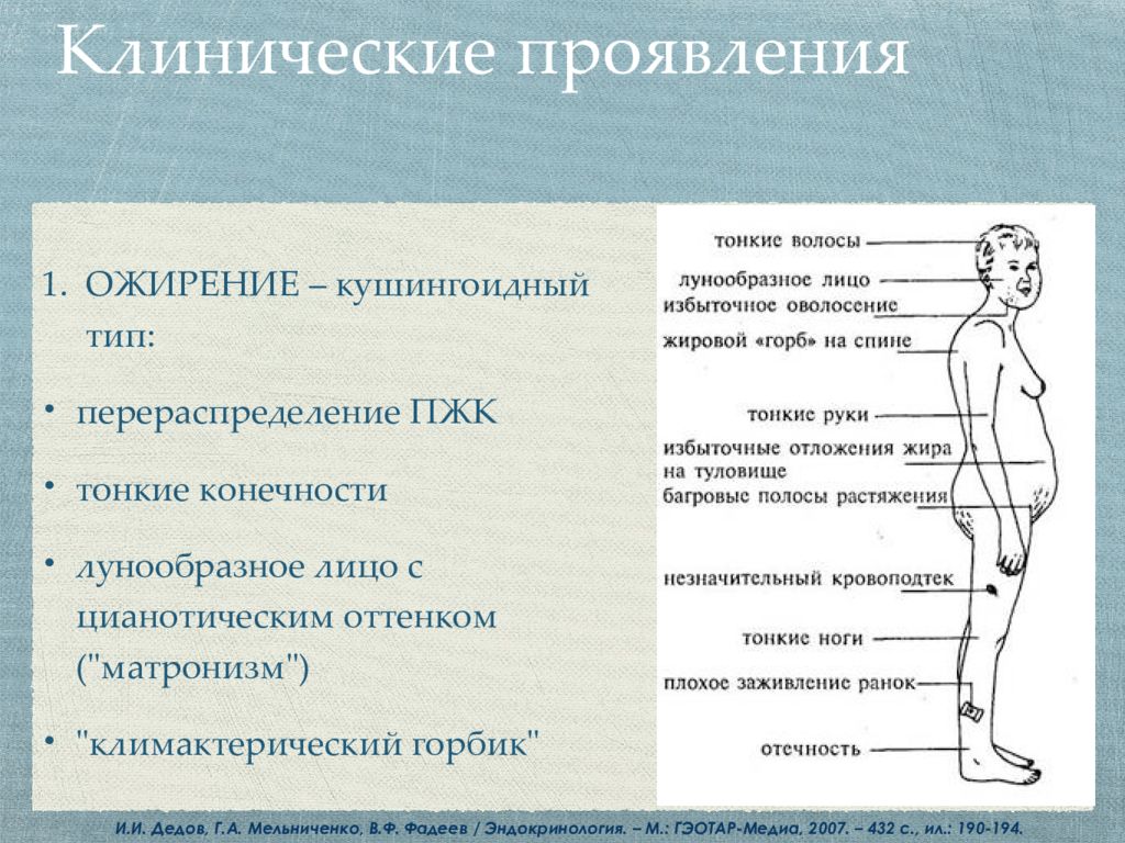 Синдром и болезнь иценко кушинга презентация