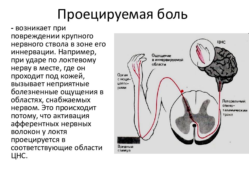 Физиология анализаторов. Строение болевого анализатора. Физиология боли. Ноцицептивный анализатор. Болевой анализатор физиология схема. Болевой анализатор функции строение анализатора.