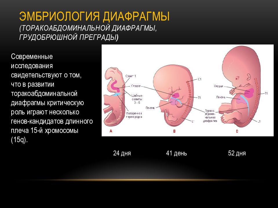 Презентация грыжи диафрагмы