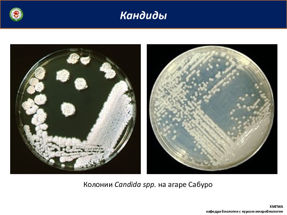 Кандидоз микробиология презентация