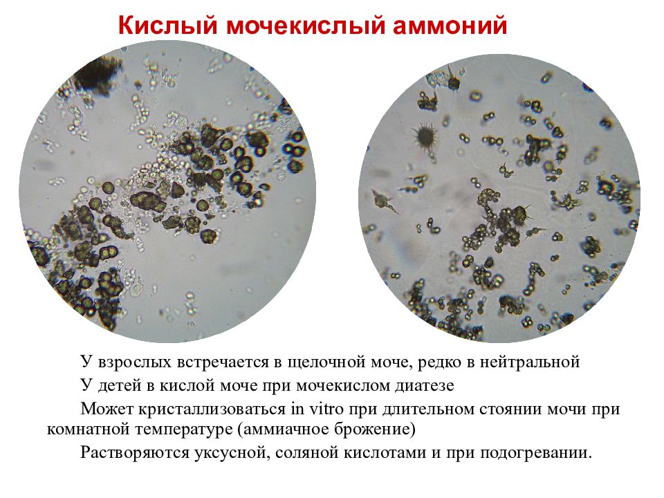 Микроскопия осадка мочи фото с описанием