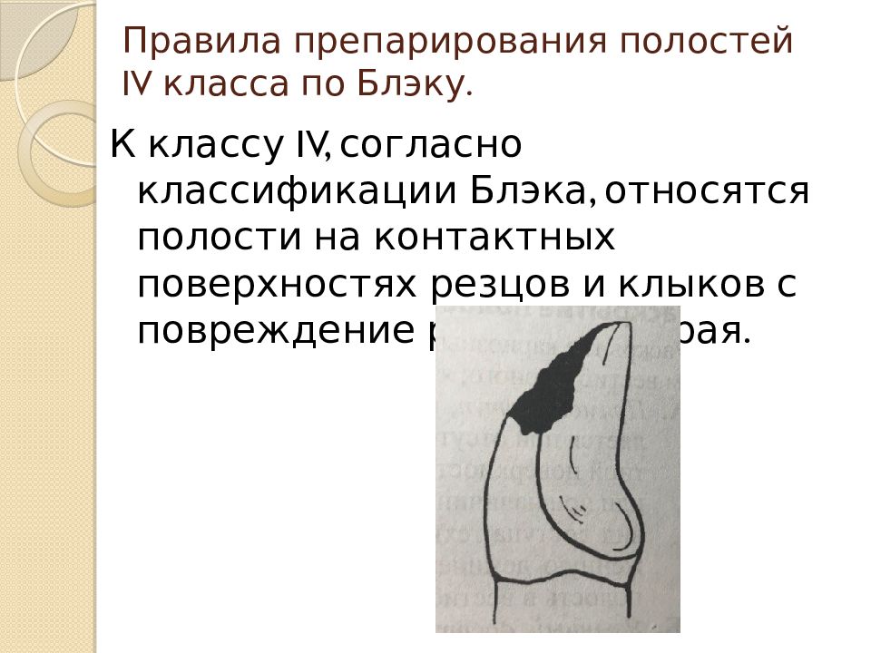 Классы полостей. 4 Класс Блэка препарирование. 1 Класс Блэка препарирование. Препарирование полостей 4 класса по Блэку. Препарирование 1 класса по Блэку.