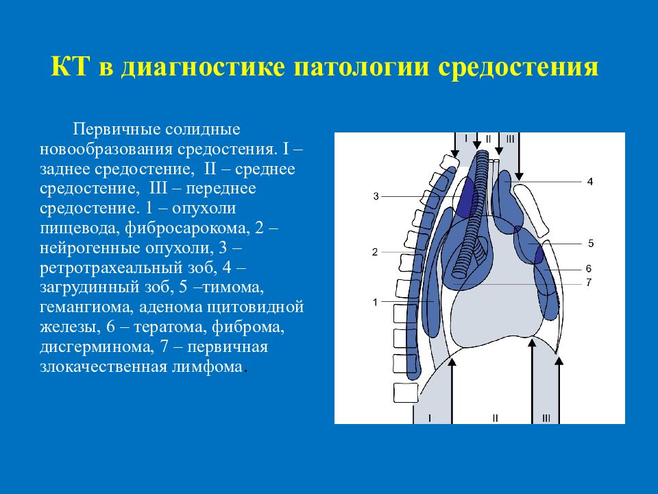 Образования средостения схема