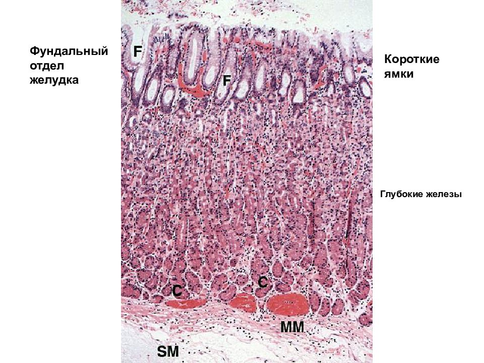 Антральные железы желудка. Антральный отдел желудка гистология. Фундальный отдел желудка. Фундальный отдел желудка гистология. Фундальные железы.