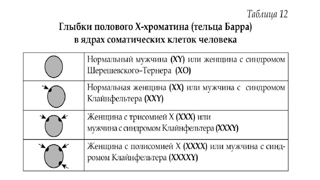 Тельца барра в клетках. Синдром Шерешевского Тернера половой хроматин. Синдром Шерешевского Тернера тельце Барра. Синдром Клайнфельтера половой хроматин. Синдром Клайнфельтера тельца Барра.