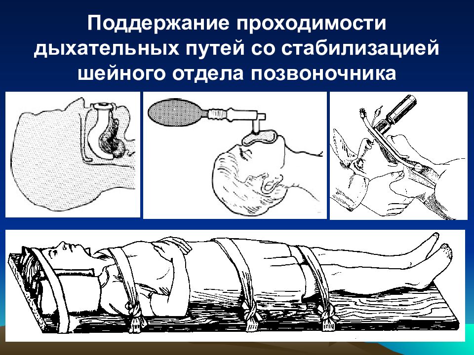 Сочетанная политравма. Поддержание проходимости дыхательных путей. Политравма патогенез. Комбинированная травма.