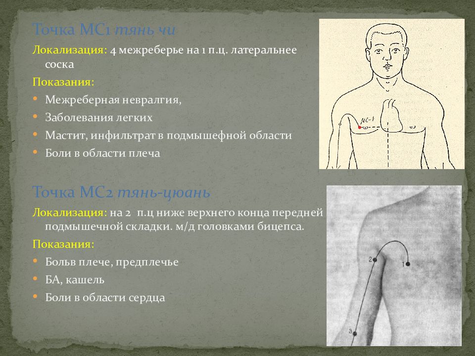 Какие упражнения при межреберная невралгия