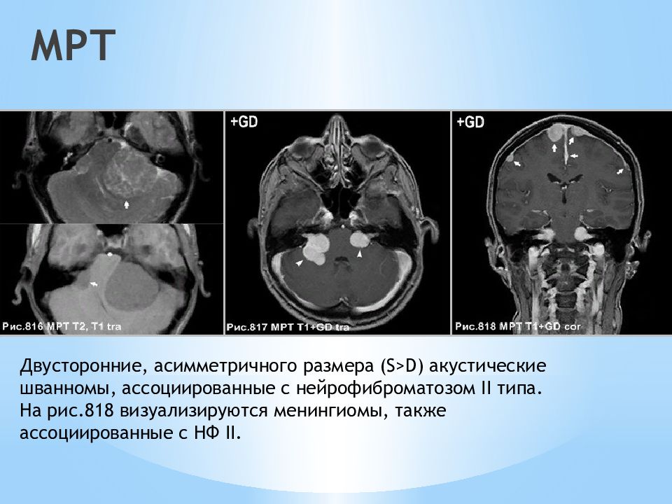 8 пара чмн презентация