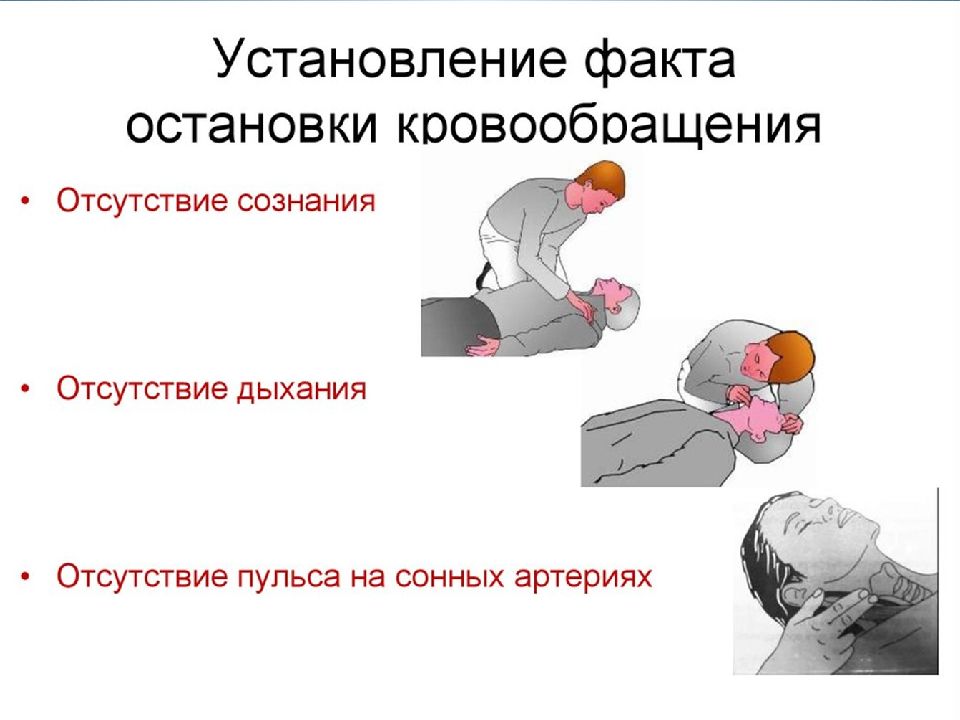 Первая помощь сердечно легочная реанимация обж 10 класс презентация