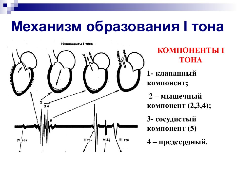 Схема тоны сердца