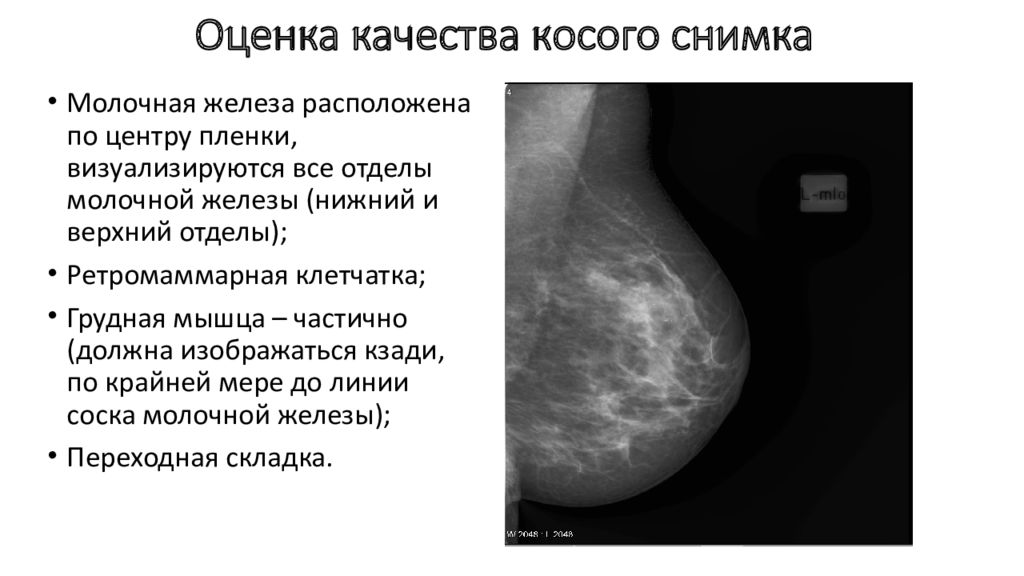 Маммография проводится в период