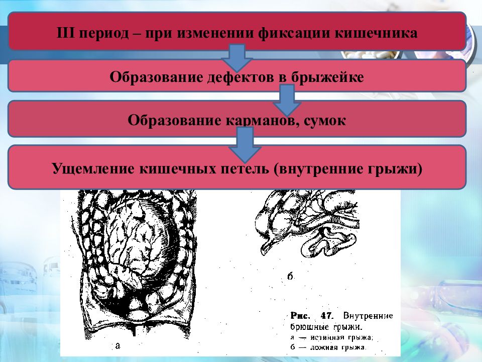 Фиксирует изменения. Формирование кармашек на кишке. Застойная кишечная петля. Субэпителиальные образования кишечника. Ложные карманы образуется при.