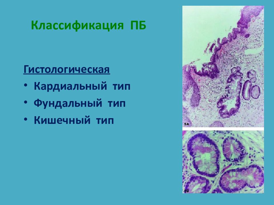 Хирургические заболевания пищевода презентация