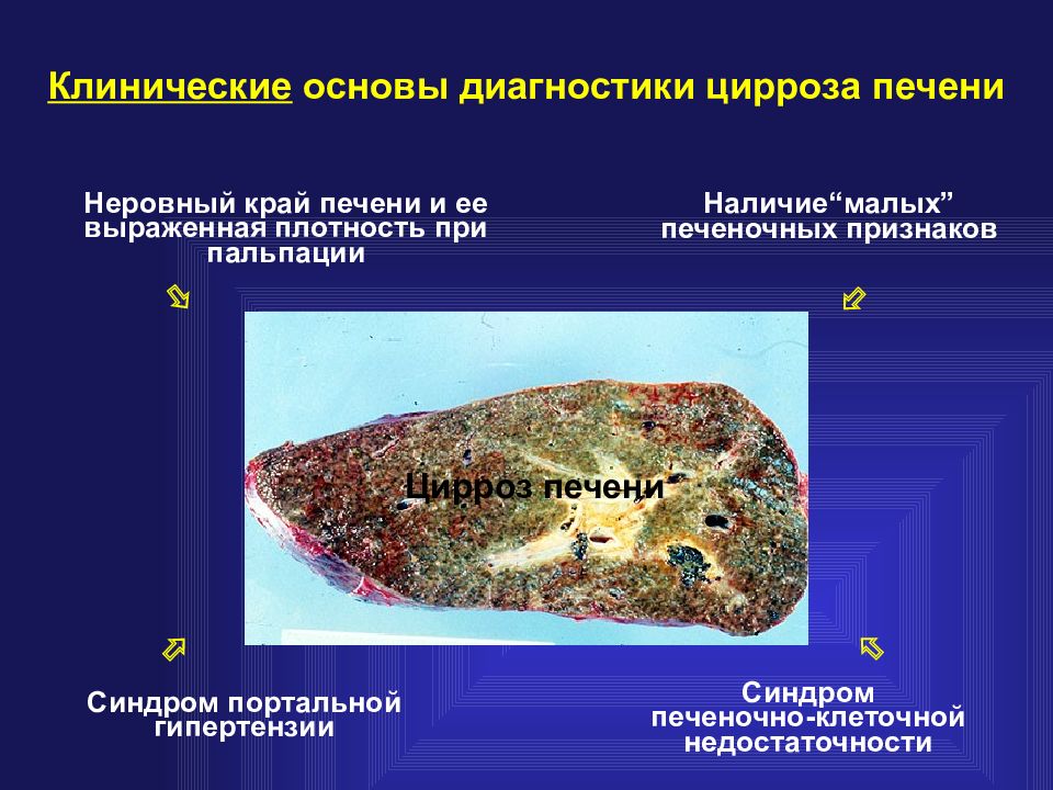 Диагностика печени. Диагностика цирроза печени. Методы обследования при циррозе печени. Инструментальные методы диагностики цирроза печени. Наиболее достоверным методом диагностики цирроза печени является.