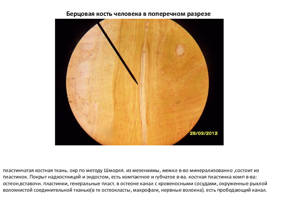 Берцовая кость препарат. Берцовая кость человека в поперечном разрезе препарат гистология. Костная ткань продольный срез препарат. Берцовая кость поперечный срез препарат. Костная ткань, берцовая кость человека в поперечном разрезе.