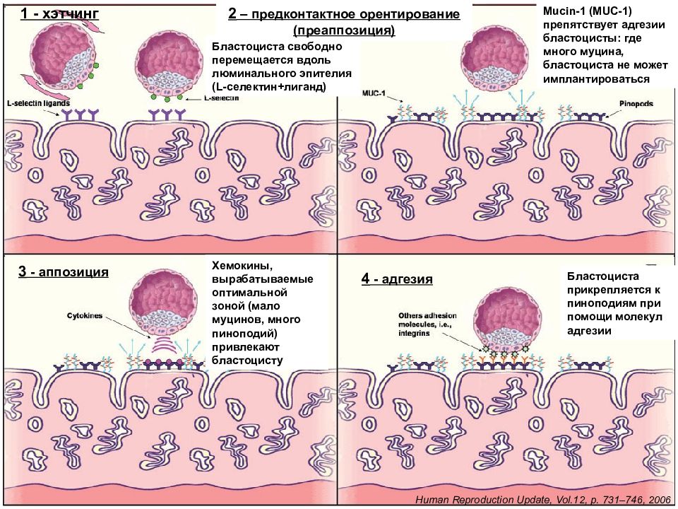Внедрение в эндометрий. Стадии имплантации бластоцисты. Люминальный эпителий эндометрия. Этапы имплантации бластоцисты. Бластоциста гистология.