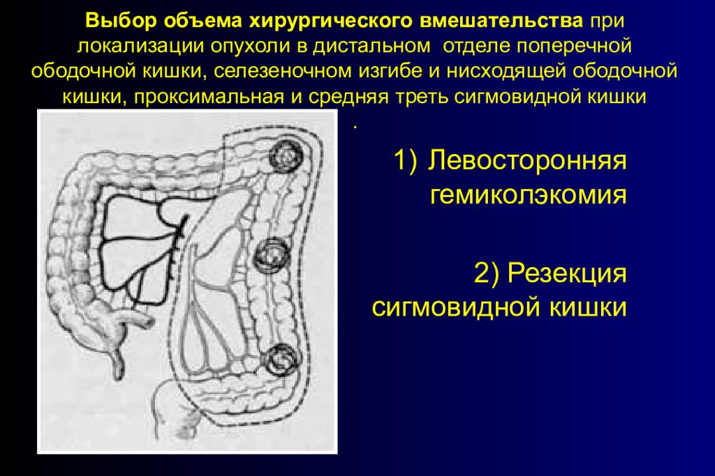 Строение стенки сигмовидной кишки