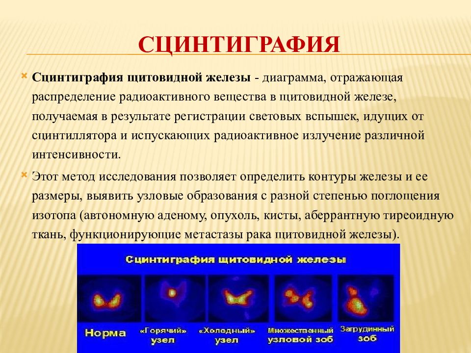 Сцинтиграфия желез. Радиоизотопное исследование щитовидной железы. Сцинтиграфия щитовидной железы показания. Норма сцинтиграфии щитовидной железы. Радиоизотопная сцинтиграфия щитовидной железы.