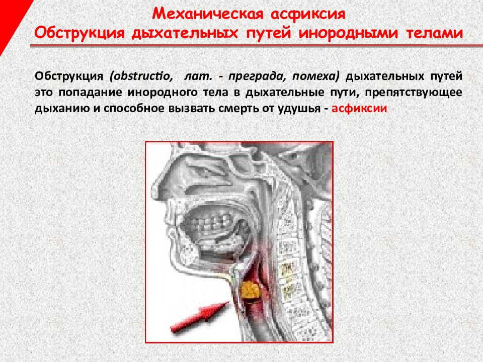 Механическая асфиксия презентация