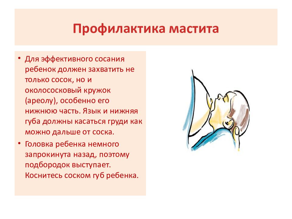 Лактационный мастит презентация