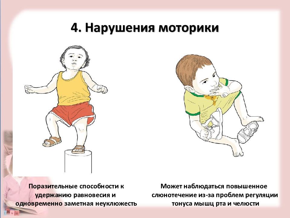 Нарушение моторики