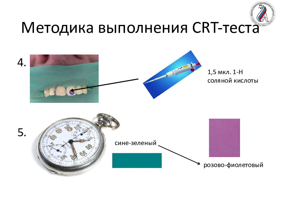 Косрэ тест. Тэр тест методика. Тэр тест стоматология оценка.