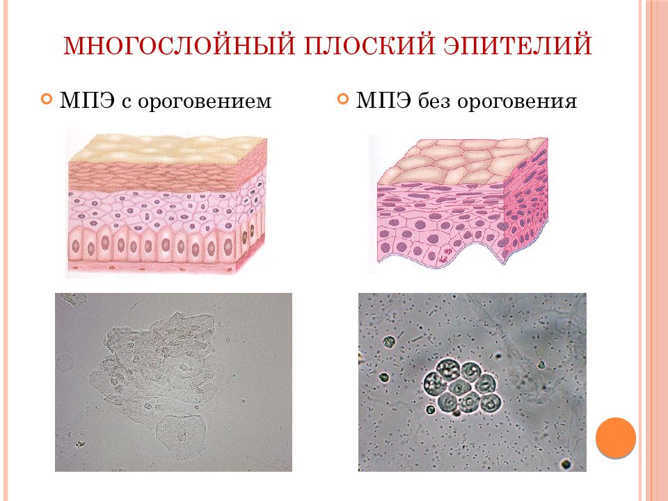 Многослойный плоский эпителий. Многослойный плоский ороговевший эпителий. Эпителий многослойный ороговевший строение местонахождение. Многослойный плоский ЭПТ.