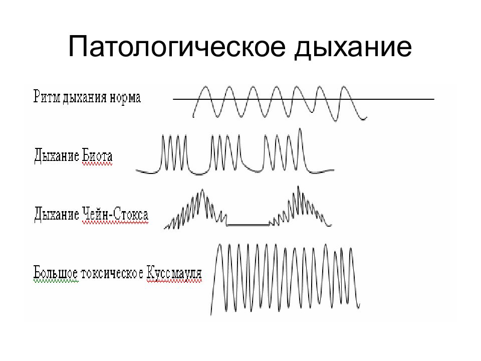 Патологическое дыхание виды. Дыхание Биота Чейна Стокса Куссмауля. Типы дыхания Чейна Стокса Куссмауля. Дыхание Куссмауля схема.