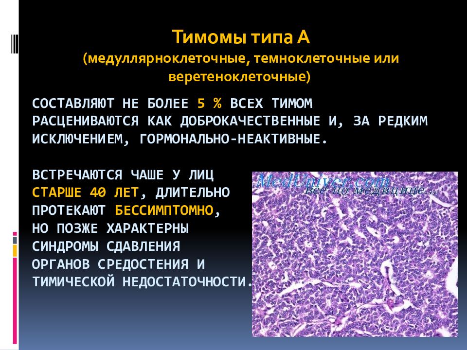 Тимома. Тимома гистологические типы. Злокачественная тимома гистология. Злокачественная опухоль вилочковой железы.