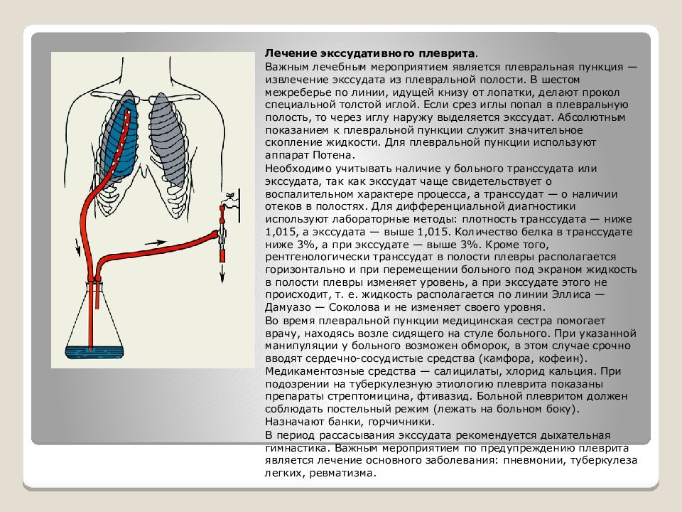 Плеврит легких без температуры