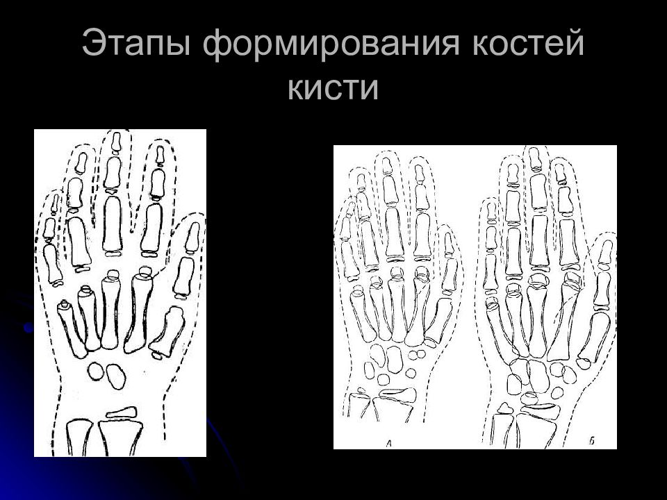 Формирование костей. Развитие костей запястья. Формирование костей запястий. Кости кисти развитие. Кости кисти мнемоника.