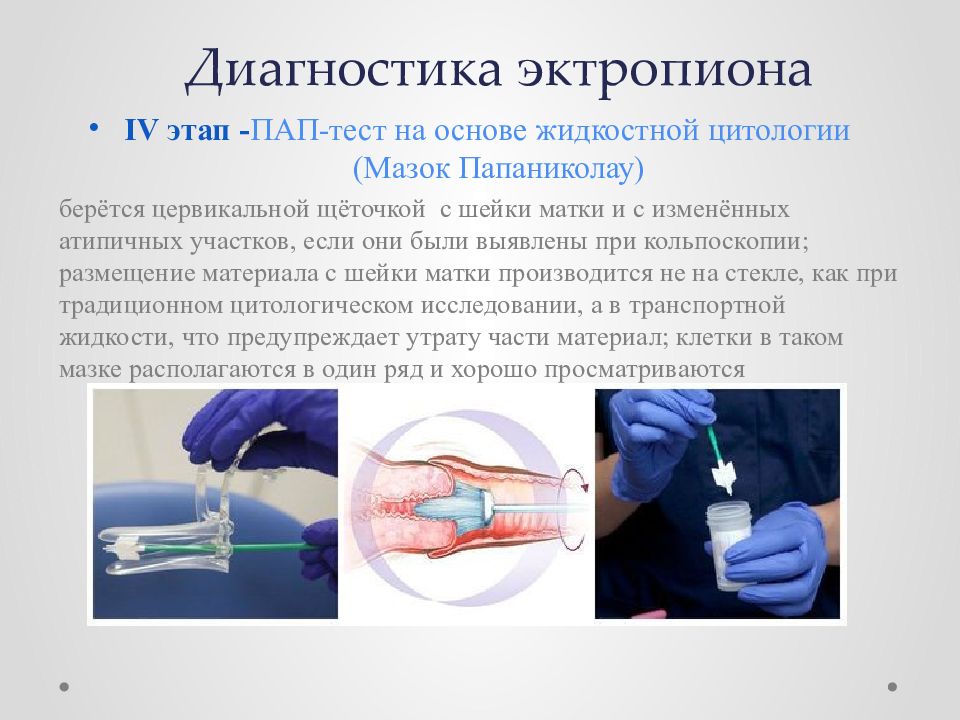 Эктропион шейки матки лечение