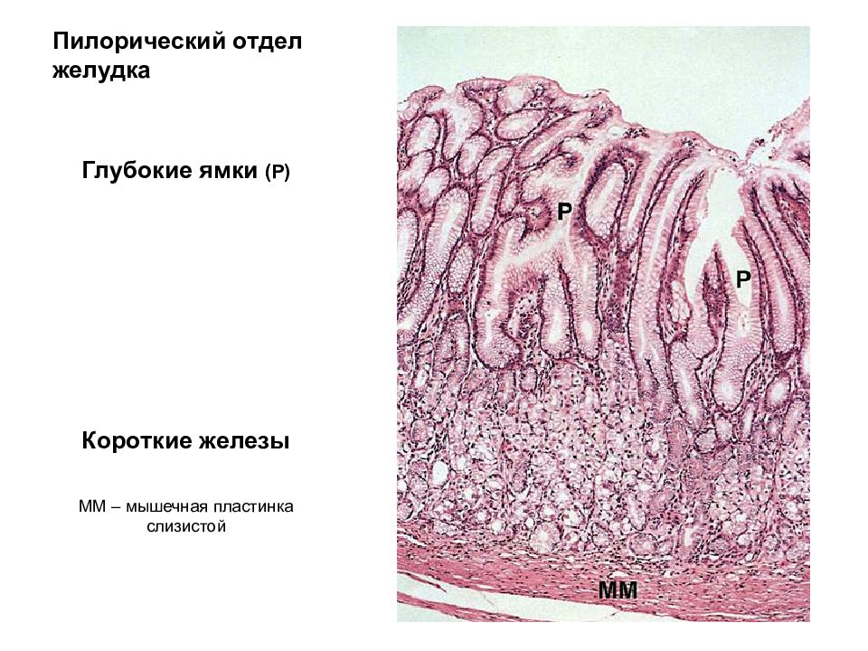 Пилорический отдел желудка гистология рисунок