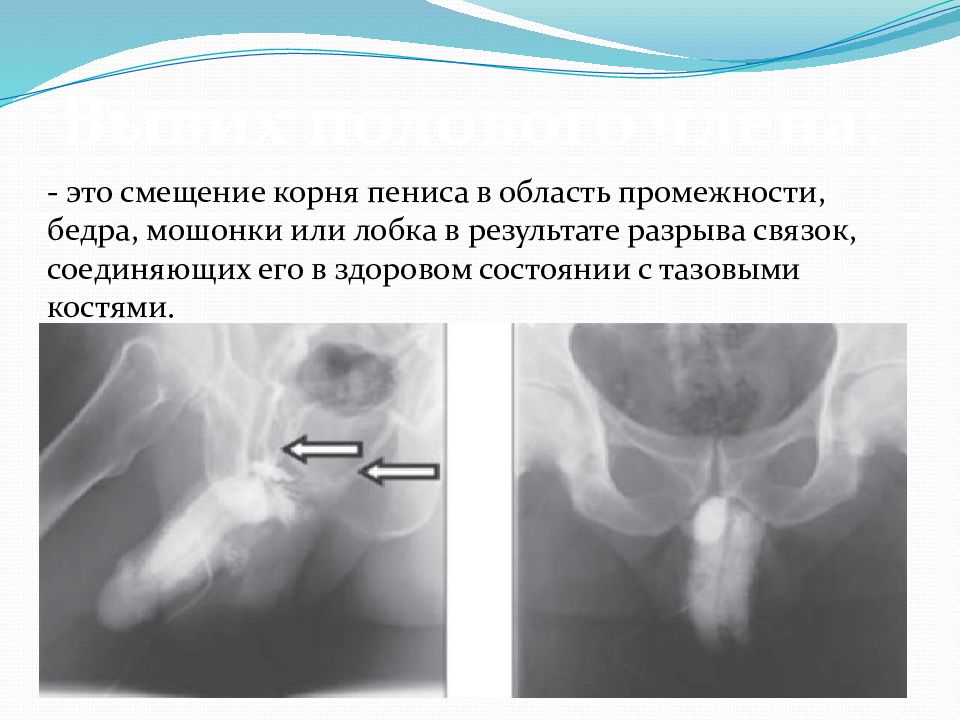 Презентация члена