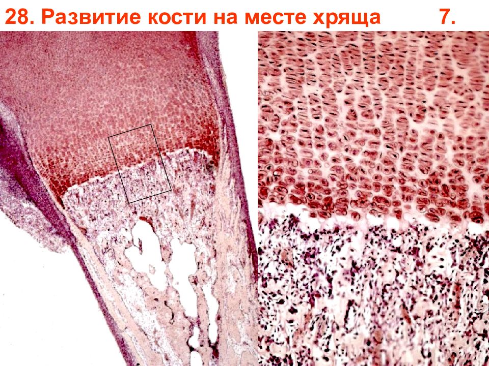 Развитие кости на месте хряща рисунок