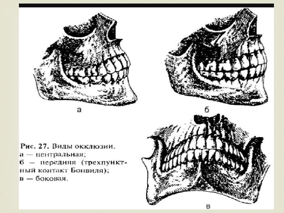 Правая окклюзия. Окклюзия челюсти боковая. Артикуляция и окклюзия.