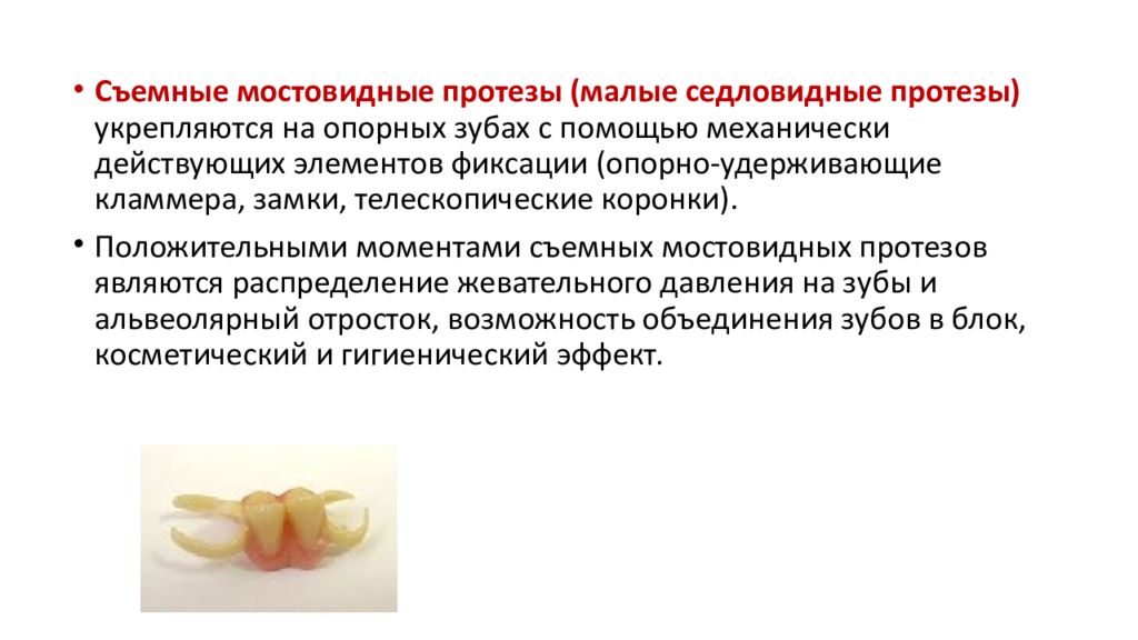 Виды мостовидных протезов. Мостовидный протез показания. Мостовидный протез клинические показания. Показания к изготовлению мостовидных протезов. Мостовидные протезы классификация.