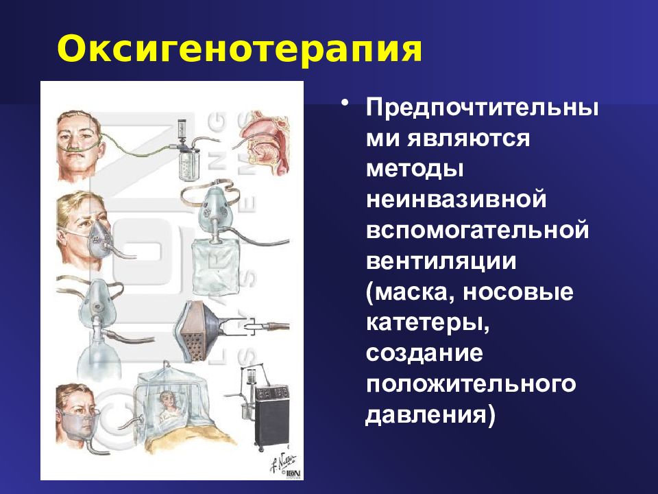 Оксигенотерапия алгоритм. Оксигенотерапия. Проведение оксигенотерапии. Проведение оксигенотерапии алгоритм.