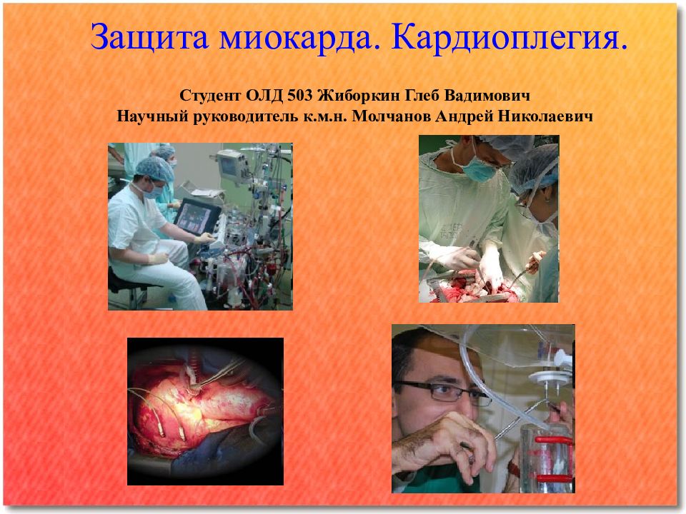 Защита миокарда. Кардиоплегия. Студент ОЛД 503 Жиборкин Глеб Вадимович Научный руководитель к.м.н. Молчанов Андрей Николаевич