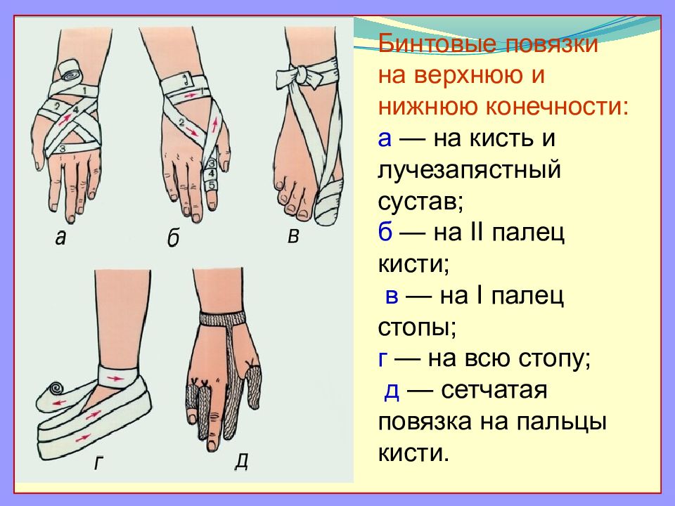 Бинтовые повязки презентация