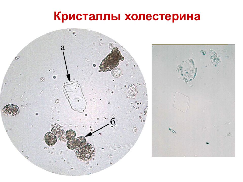 Микроскопия осадка мочи фото с описанием