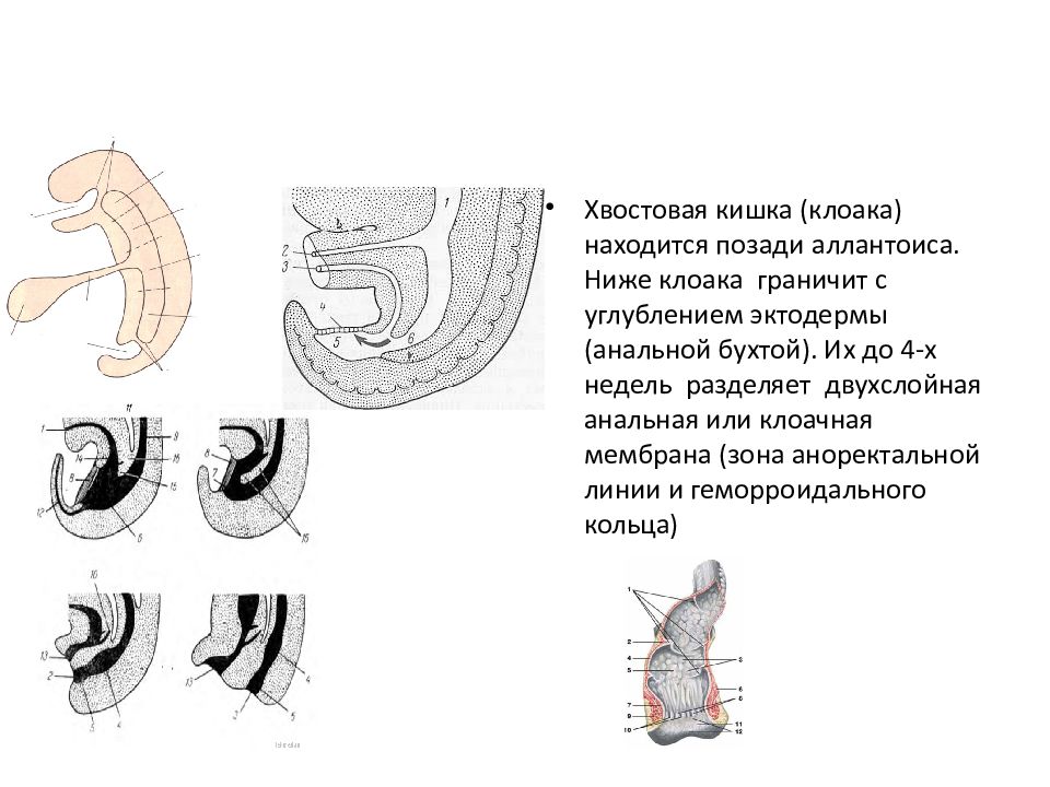 Диего клоака. Аномалии развития пищеварительной системы. Клоака у эмбриона человека.