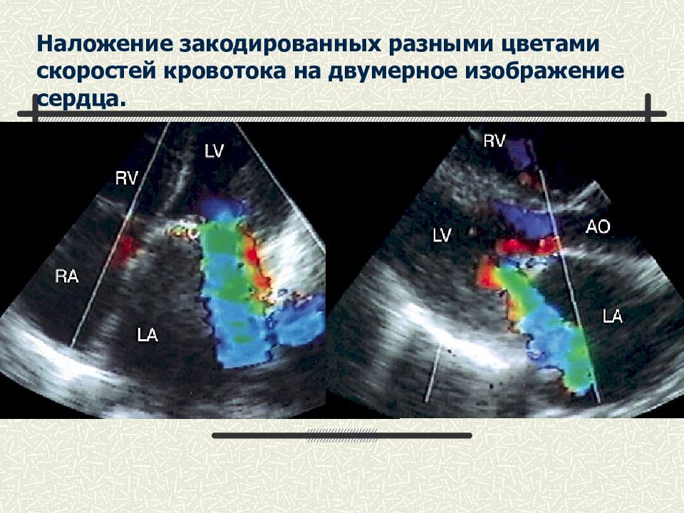 Методы обследования в кардиологии презентация