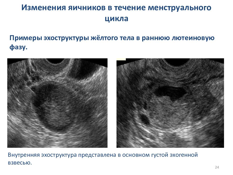 Цикл узи. Эхоструктура яичников. Возрастные изменения яичника. Циклические изменения в яичнике. Изменения яичников в течение цикла.